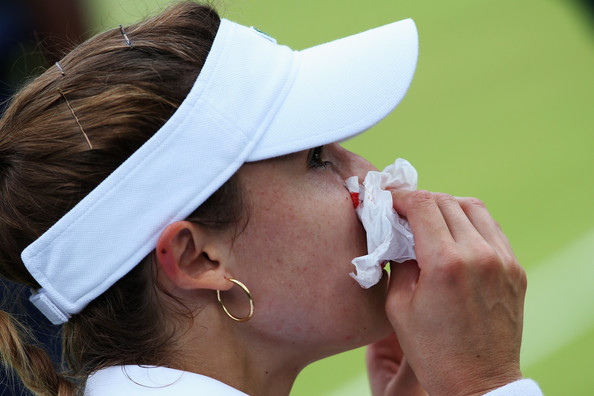 Cornemort had a nose bleed on court ... blood magic I say!!